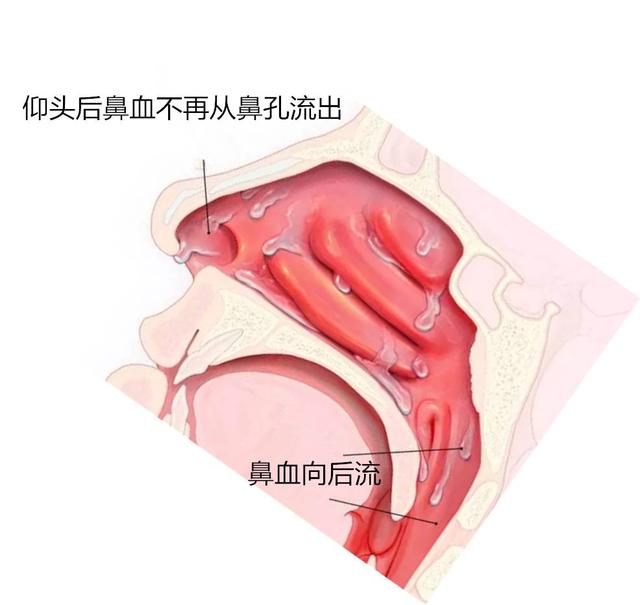 小面积烧伤的家庭急救处理方法