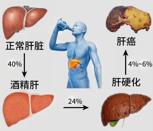 中医肝脏调理与压力缓解之道